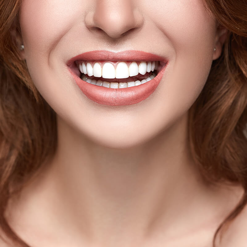 Woman Smiling with White Teeth